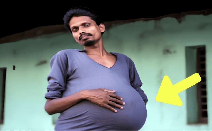 Man Gets Routine Check-Up – Doctor Looks At X-Ray And Whispers: “I’m Sorry” ➤ blog.thegamesday.com