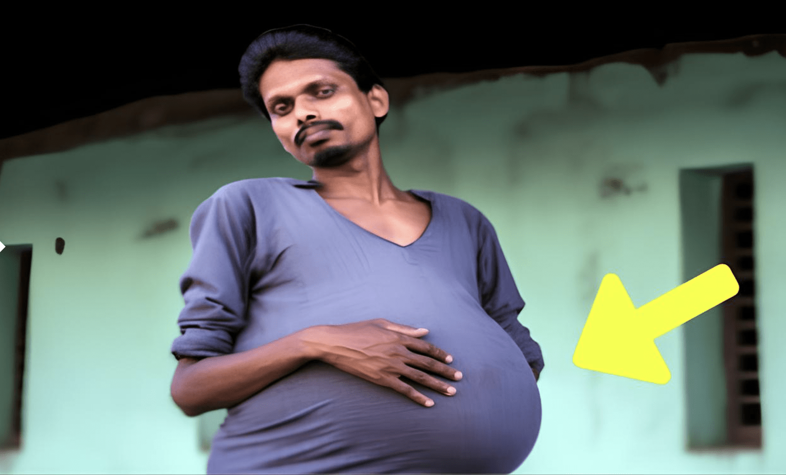 Man Gets Routine Check-Up – Doctor Looks At X-Ray And Whispers: “I’m Sorry” ➤ blog.thegamesday.com
