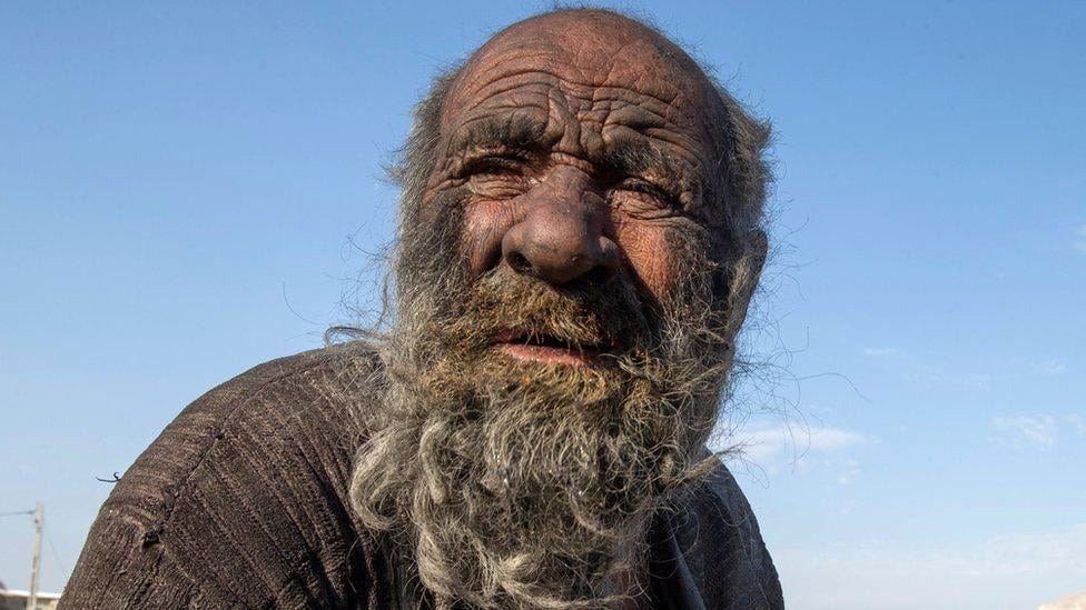 Ugh! This man hasn’t washed in 65 years! ➤ blog.thegamesday.com